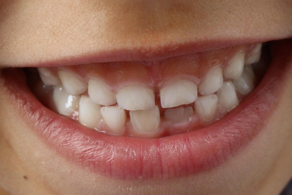 The Shocking Truth Behind Your Throbbing Tooth with No Cavity!